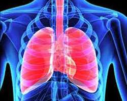 Marché du traitement des maladies pulmonaires chroniques
