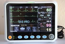 Marché des électrocardiographes de diagnostic (ECG)