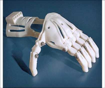 L'impression 3D dans le secteur de la santé marché