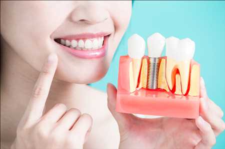 Parodontie dentaire marché